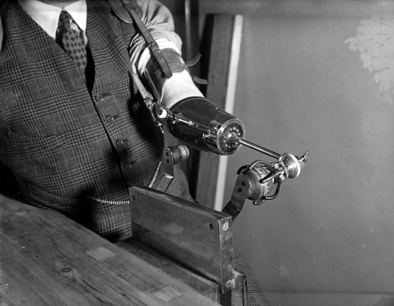 Illustration for article titled The History of Prosthetics Reveals a Long Tradition of Human Cyborgs